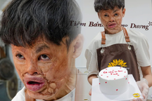 Chàng trai cháy cả gương mặt mở tiệm bánh bán... tình yêu
