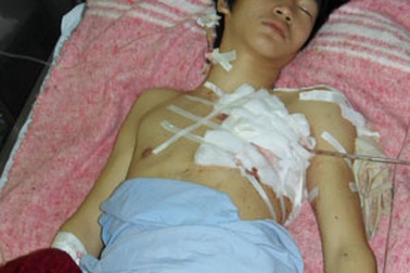 Một học sinh bị đâm thủng tim, phổi
