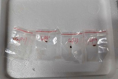 Nhà khoa học Trung Quốc bị cáo buộc mang “nấm khủng bố” vào Mỹ