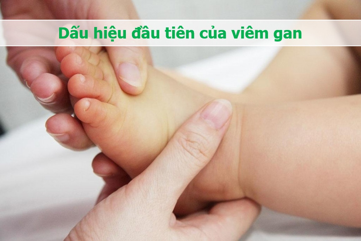 Thông tin bất ngờ về nguồn gốc của dịch viêm gan bí ẩn - 3 Thông tin bất ngờ về nguồn gốc của dịch viêm gan bí ẩn - 3