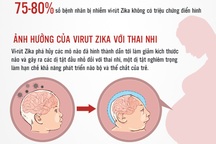 Infographics: Toàn cảnh về khả năng vi rút Zika "tấn công" thai phụ