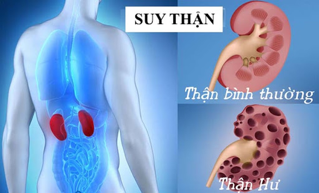 Những bất thường trên cơ thể cảnh báo chức năng thận suy giảm - 1