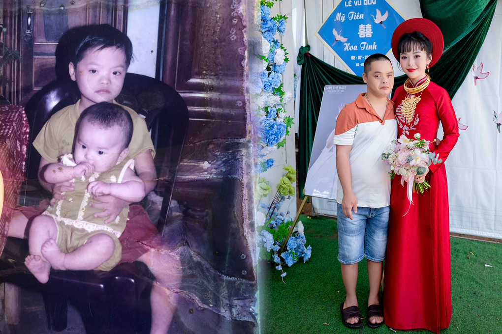 Anh bị Down tặng em gái 1 chỉ vàng ngày cưới khiến nhiều người rơi nước mắt - 3 Anh bị Down tặng em gái 1 chỉ vàng ngày cưới khiến nhiều người rơi nước mắt - 3