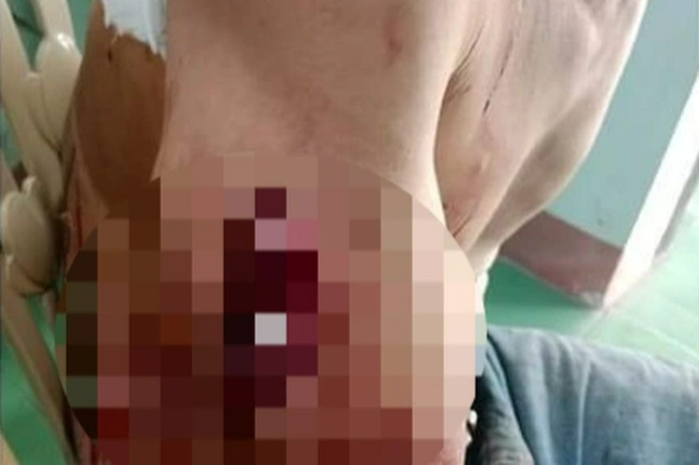 Đập vỡ bát tô lấy mảnh sành đâm hàng xóm nhiều nhát - 1 Đập vỡ bát tô lấy mảnh sành đâm hàng xóm nhiều nhát - 1