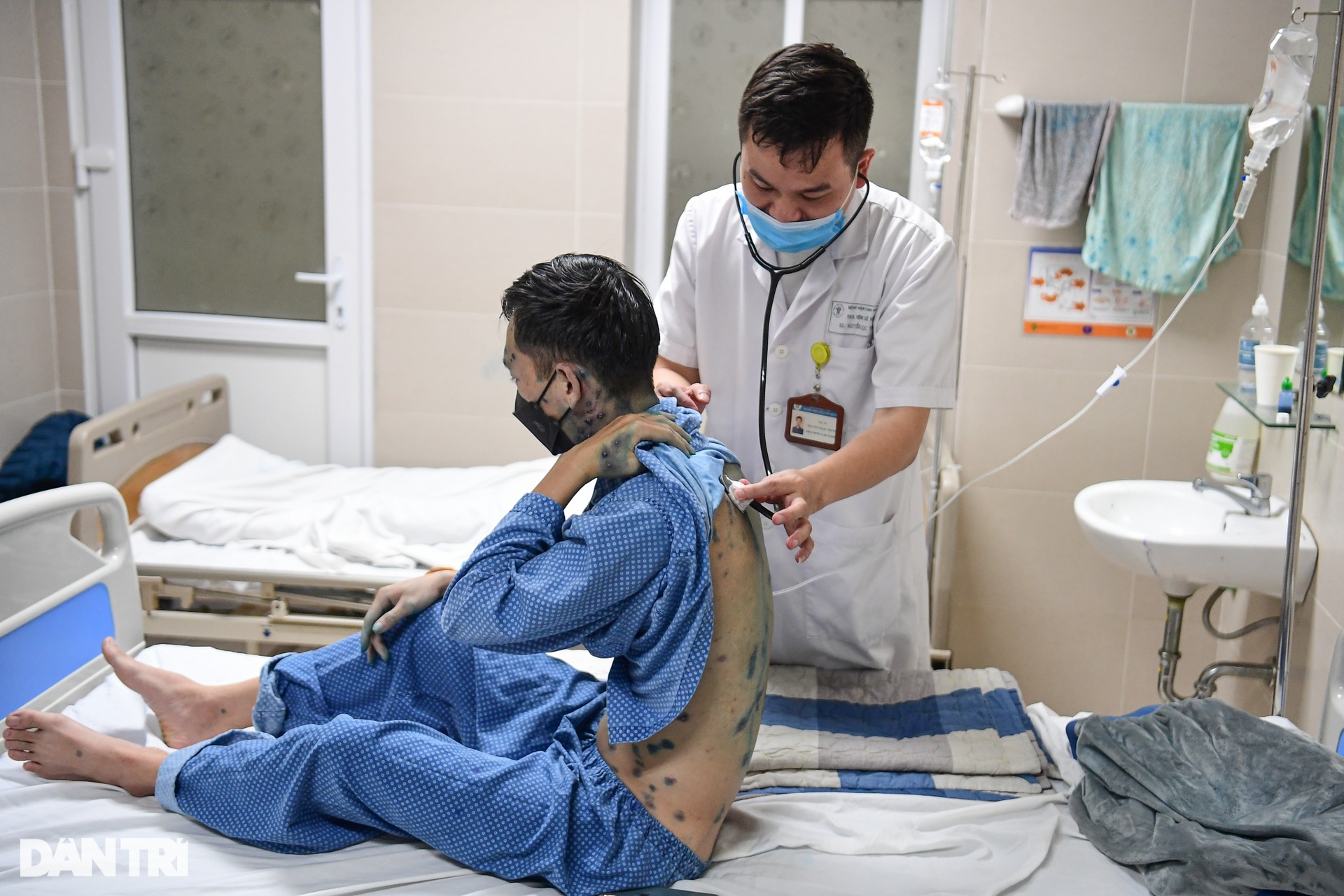 Hà Nội: Nhiều người nổi mụn nước chi chít phải nhập viện vì dịch bất thường - 11 Hà Nội: Nhiều người nổi mụn nước chi chít phải nhập viện vì dịch bất thường - 11