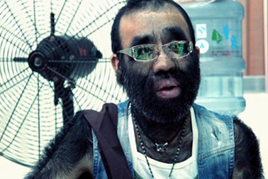 Người rậm lông muốn phẫu thuật mũi