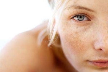 Nám sạm da - Ác mộng của chị em 