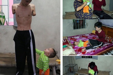 Rớt nước mắt cảnh người cha trẻ mất đôi tay chăm bé thơ khát sữa