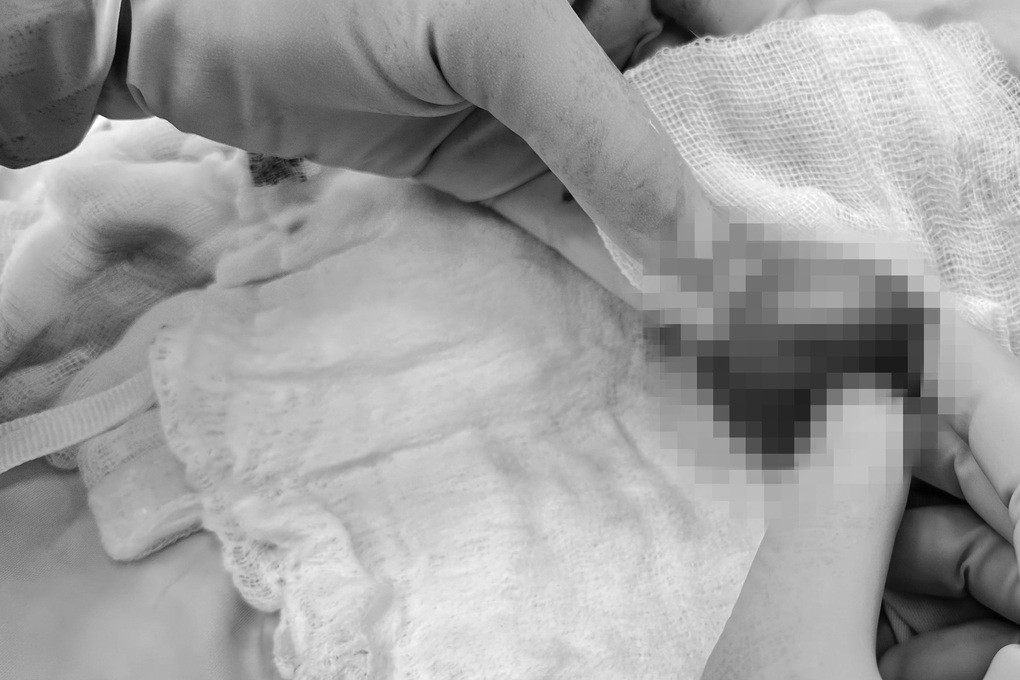 Đột ngột đau vùng kín lúc nửa đêm, chàng trai ở TPHCM suýt mất tinh hoàn - 1