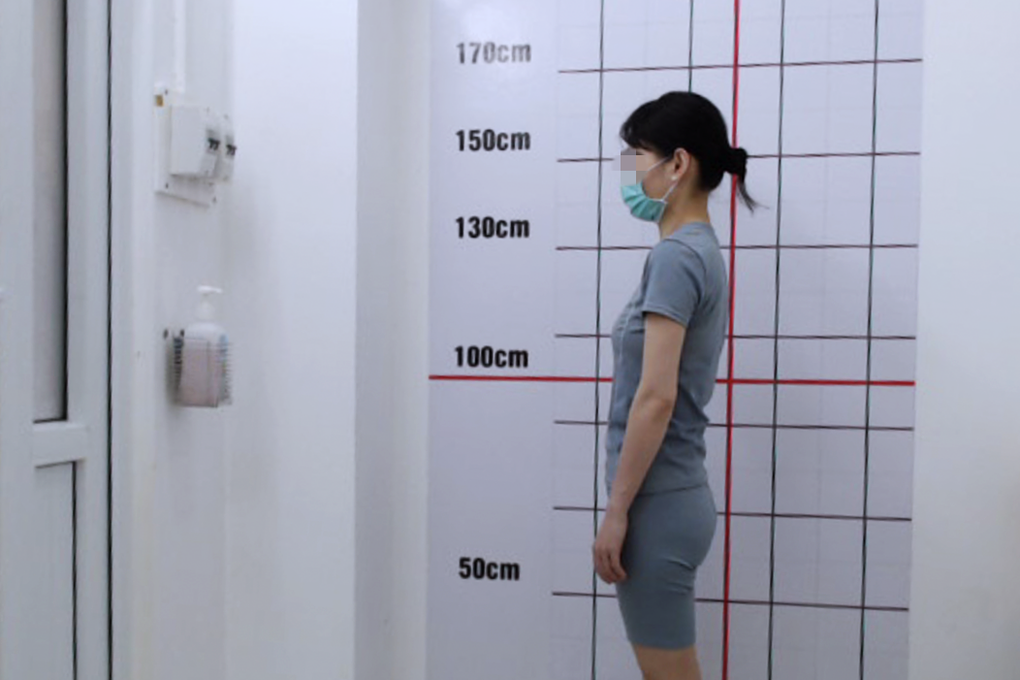 Gù lưng, thoái hóa khớp, đổi dáng sau khi mang thai và khuyến cáo từ bác sĩ - 1 Gù lưng, thoái hóa khớp, đổi dáng sau khi mang thai và khuyến cáo từ bác sĩ - 1