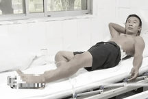 Trung Quốc: Bị sét đánh 2 lần liên tiếp, người đàn ông vẫn sống kỳ diệu