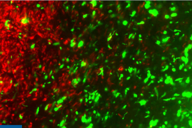 Phương pháp chỉnh sửa gen để đối phó với ung thư