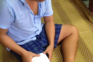 Vụ bệnh nhân bị cưa chân: Gia đình đề nghị khởi tố bác sĩ