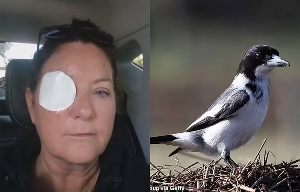 Người phụ nữ lĩnh hậu quả nặng nề khi cho chim ăn - 1 Người phụ nữ lĩnh hậu quả nặng nề khi cho chim ăn - 1