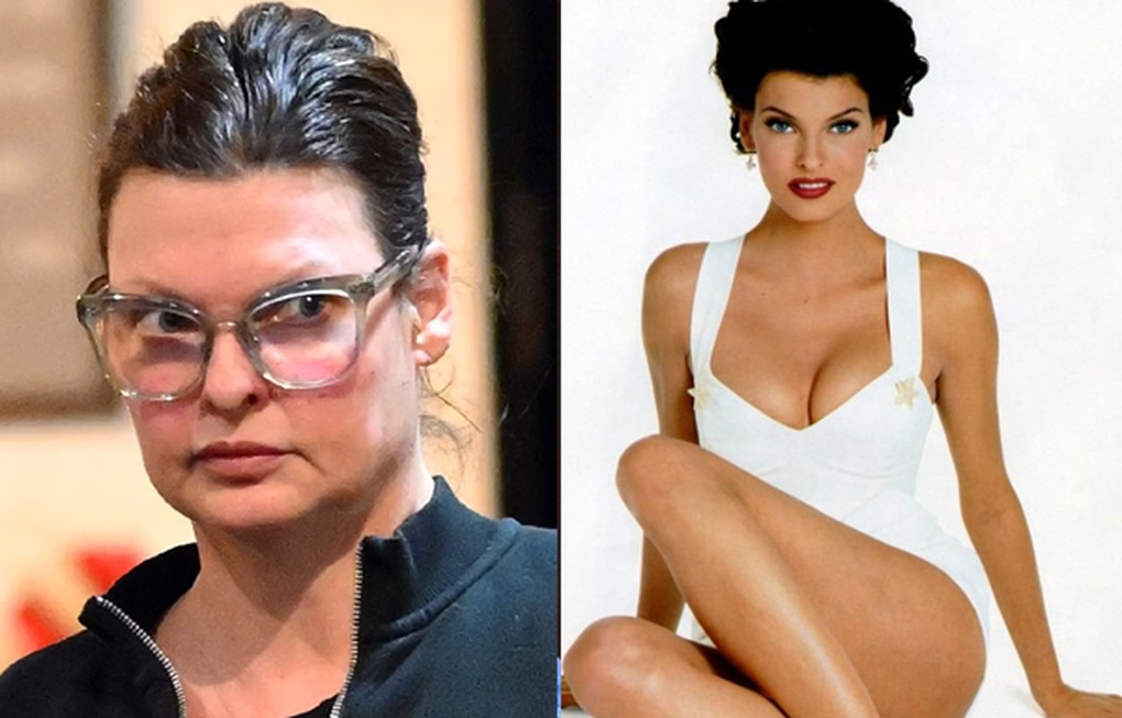 Linda Evangelista tái xuất quyến rũ sau ca phẫu thuật thẩm mỹ hỏng - 1 Linda Evangelista tái xuất quyến rũ sau ca phẫu thuật thẩm mỹ hỏng - 1