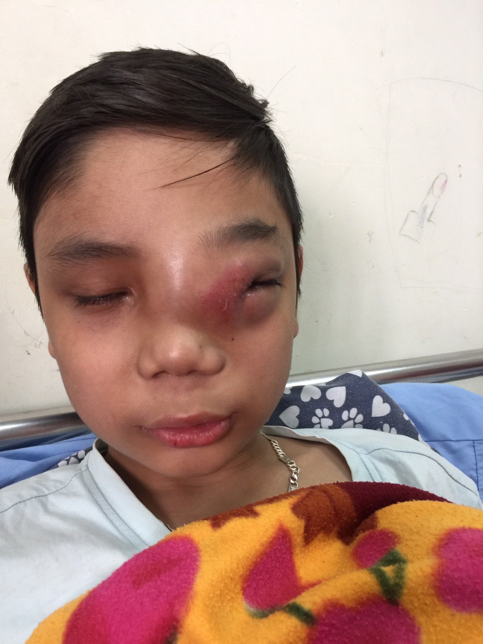 Nghẹn ngào tiếng kêu cứu của cậu bé 12 tuổi, con đau lắm mẹ ơi! - 1 Nghẹn ngào tiếng kêu cứu của cậu bé 12 tuổi, con đau lắm mẹ ơi! - 1