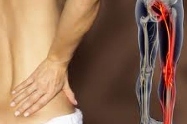 Chớ coi thường đau dây thần kinh liên sườn