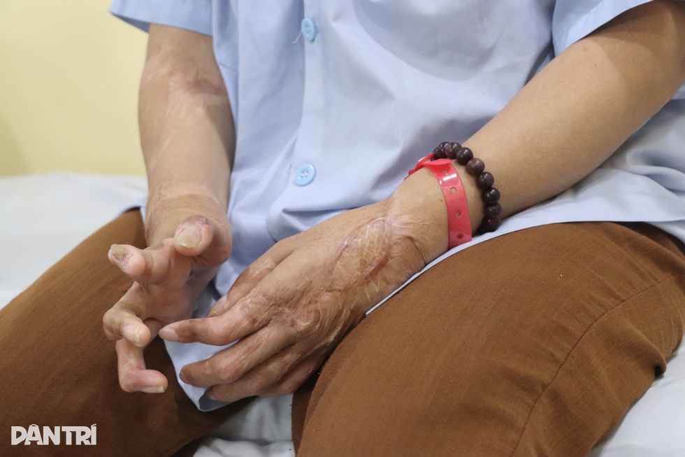 Những ca mổ “0 đồng” giúp hàng trăm người tìm lại hình hài sau biến cố - 7