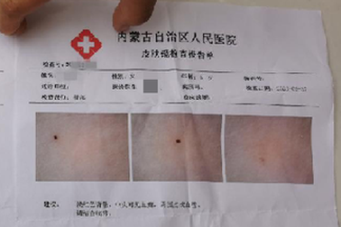 Trung Quốc: 3 giáo viên mầm non bị nghi dùng kim đâm học sinh