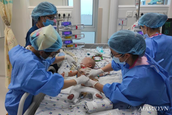 "Chứng nhân” của 6 ca tách dính tại Việt Nam kể lại khoảnh khắc căng não chia đại tràng cho Trúc Nhi – Diệu Nhi - Ảnh 3. "Chứng nhân” của 6 ca tách dính tại Việt Nam kể lại khoảnh khắc căng não chia đại tràng cho Trúc Nhi – Diệu Nhi - Ảnh 3.