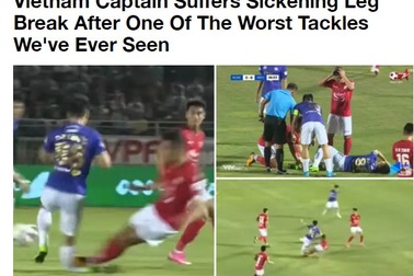 Báo chí thế giới lên án pha tắc bóng kinh hoàng của Ngô Hoàng Thịnh