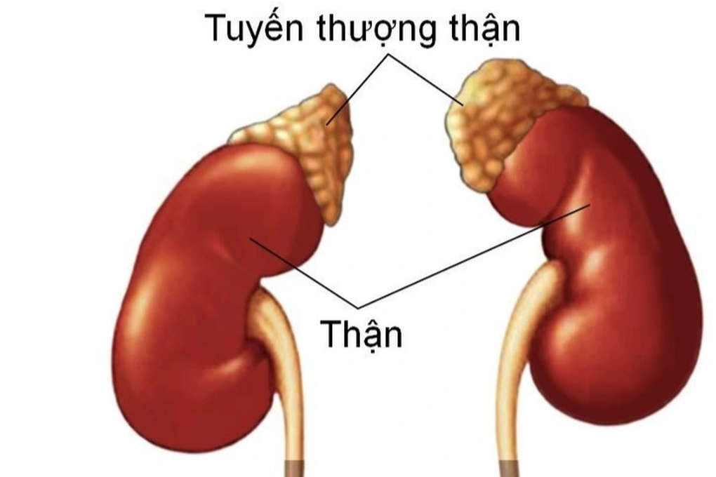 Phát hiện khối u từ cơn đau bụng bất thường - 1 Phát hiện khối u từ cơn đau bụng bất thường - 1