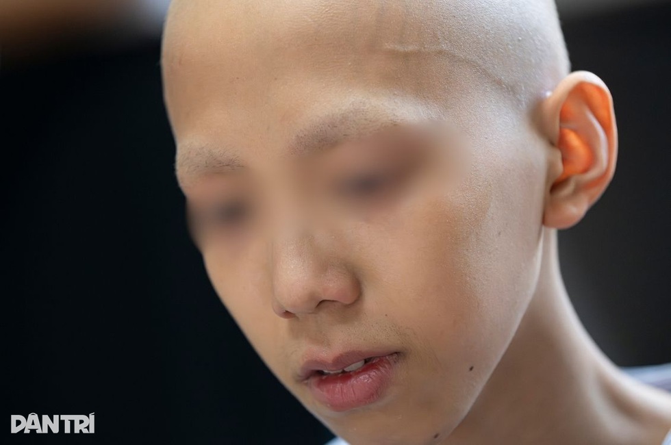 Измученный лечением рака, мальчик все еще мечтает вернуться в школу - 5 Kiệt quệ vì chữa ung thư, cậu bé vẫn ôm ước mơ được quay lại trường học - 5