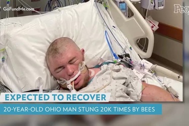 Người đàn ông hôn mê phải thở máy vì bị đàn ong sát thủ 20.000 con đốt
