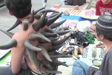 Rùng mình xem cảnh cắm sừng trâu lên lưng để giác hơi chữa bệnh