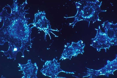 Tăng hiệu quả điều trị ung thư giai đoạn muộn bằng liệu pháp "kép"