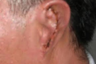 Băng cướp vờ đến thuê phòng, xẻo tai tiếp tân khách sạn cướp tài sản