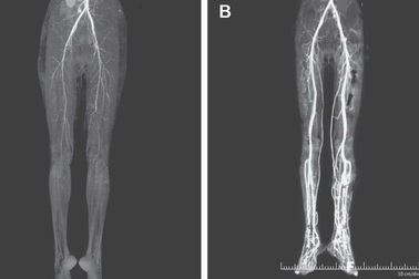 Người phụ nữ mắc căn bệnh cực hiếm có tên "Lửa thánh" thời trung cổ