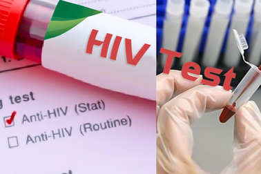 30.000 người Việt nhiễm HIV không biết mình mắc bệnh