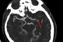TPHCM: Nửa đêm, người chồng phát hiện vợ nguy kịch ngay trong khi ngủ