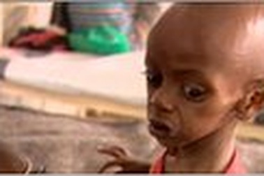 Vùng Sừng châu Phi hạn hán nghiêm trọng nhất trong 60 năm