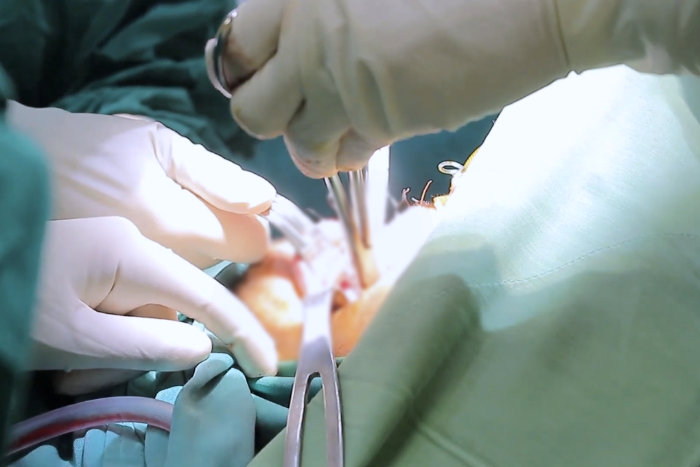 Chạy xe máy tông phải chó thả rông, người đàn ông chấn thương nghiêm trọng - 2 Chạy xe máy tông phải chó thả rông, người đàn ông chấn thương nghiêm trọng - 2