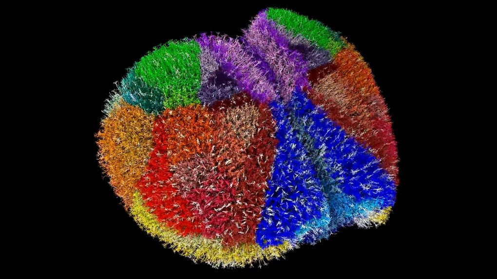 ຊຸບເປີຄອມພິວເຕີສ້າງໜຶ່ງໃນສະໝອງເສມືນທີ່ເບິ່ງຄືຈິງທີ່ສຸດ - 1 Siêu máy tính tạo ra một trong những bộ não ảo chân thực nhất - 1