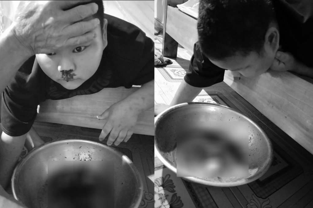 Mẹ khóc cạn nước mắt khi có ngày con trai 20 lần ộc máu mũi - 1 Mẹ khóc cạn nước mắt khi có ngày con trai 20 lần ộc máu mũi - 1