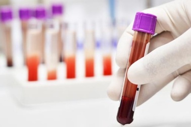 Phát hiện 13 bệnh ung thư chỉ với một giọt máu