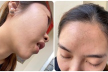 Hai nữ nhân viên y tế bị người nhà bệnh nhân túm tóc đánh