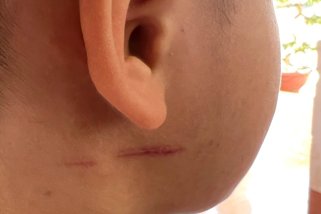 Vụ bé trai 9 tuổi bị bố và bà nội đánh đập: Người mẹ lên tiếng - 3 Vụ bé trai 9 tuổi bị bố và bà nội đánh đập: Người mẹ lên tiếng - 3