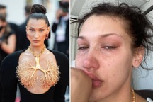 Đăng nhiều ảnh khóc lên mạng xã hội, siêu mẫu Bella Hadid muốn nói điều gì?