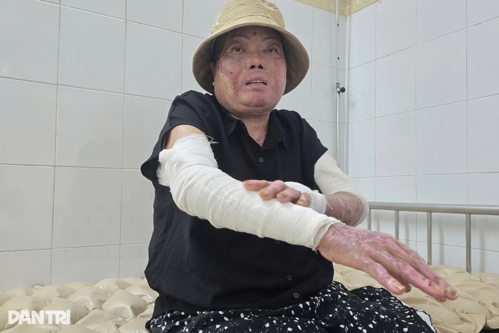 Hai nạn nhân vụ sét đánh ở Lào Cai đã hồi phục tích cực - 1