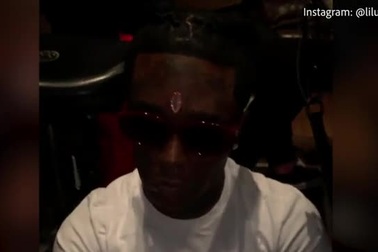 Rapper "chơi ngông" đính kim cương 550 tỷ đồng... lên trán