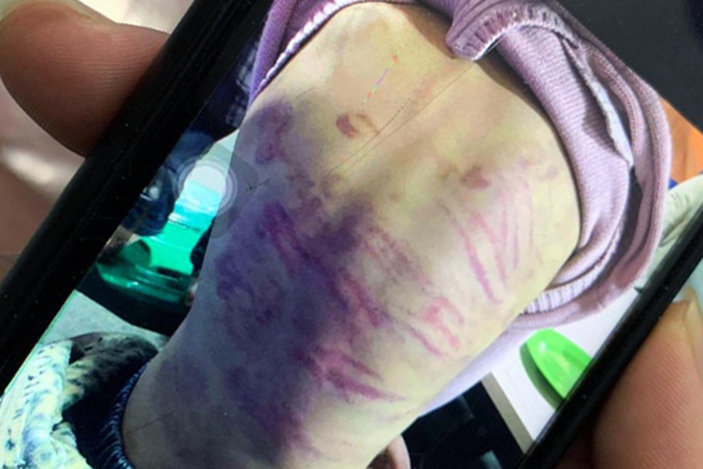 Hà Nội: Bé gái 12 tuổi nhiều lần bị nhân tình của mẹ xâm hại - 1 Hà Nội: Bé gái 12 tuổi nhiều lần bị nhân tình của mẹ xâm hại - 1