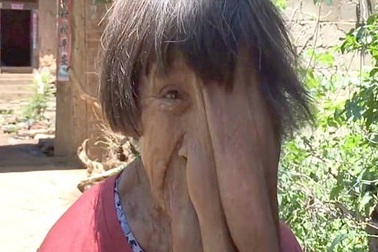 Cuộc đời bi thảm của góa phụ có biệt danh “bà voi”