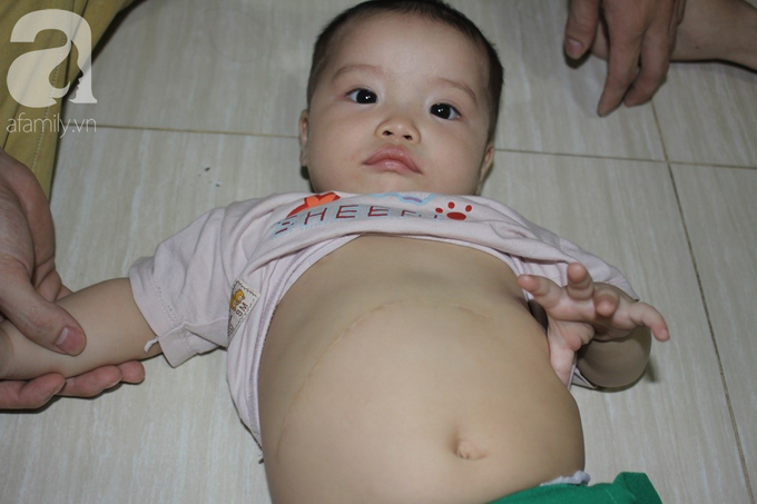 Xót cảnh bố mẹ trẻ tật nguyền đi làm thuê, gom góp tiền níu giữ mạng sống từng ngày cho con gái 9 tháng tuổi - Ảnh 1. Xót cảnh bố mẹ trẻ tật nguyền đi làm thuê, gom góp tiền níu giữ mạng sống từng ngày cho con gái 9 tháng tuổi - Ảnh 1.