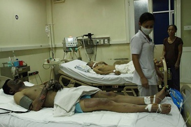 Bị tia lửa điện phóng, một công nhân cháy đen người