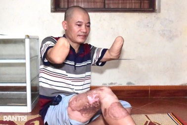 Bố tai nạn cụt 2 tay, mẹ thường đau yếu, 6 con lâm cảnh bế tắc