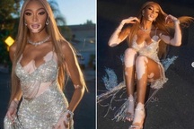 Siêu mẫu bạch biến Winnie Harlow mặc váy hở bạo đón tuổi 27